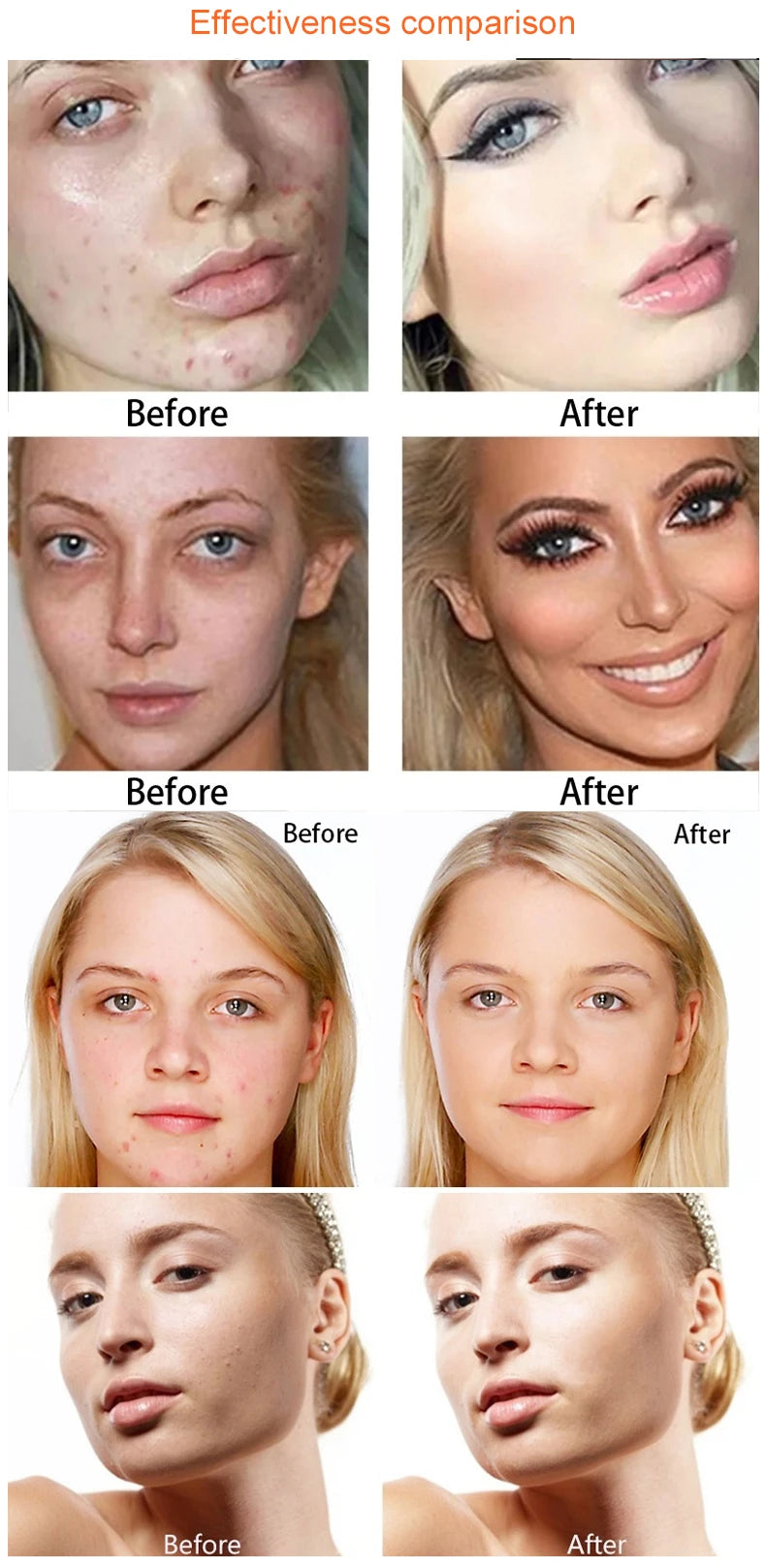 15 Colors Face Concealer Camouflage Cream